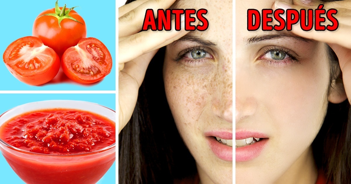 los-utiles-consejos-para-deshacerte-de-las-manchas-solares-en-la-piel-con-remedios-naturales