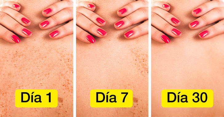 los-utiles-consejos-para-deshacerte-de-las-manchas-solares-en-la-piel-con-remedios-naturales-006